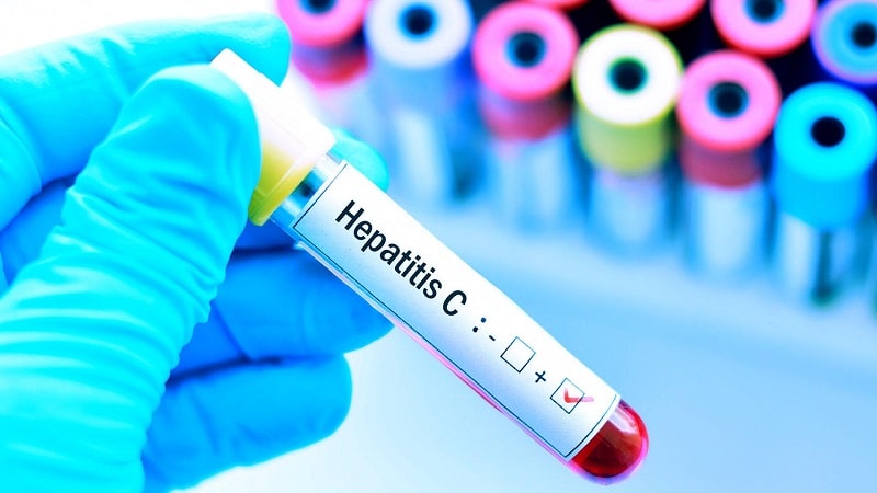 انتقال هپاتیت سی با این روش های خطرناک