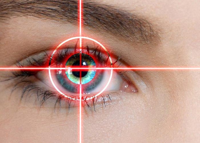 عمل لیزیک چشم چیست ؟