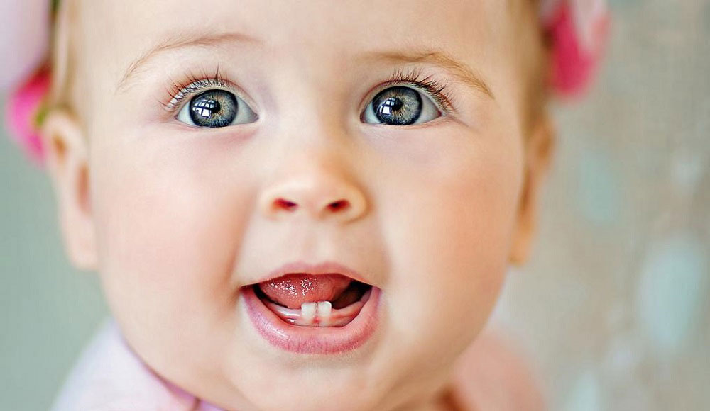 مشکل رویش دندان های شیری در خردسالان