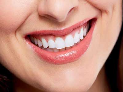لمینت کامپوزیتی دندان یا ونیر کامپوزیت