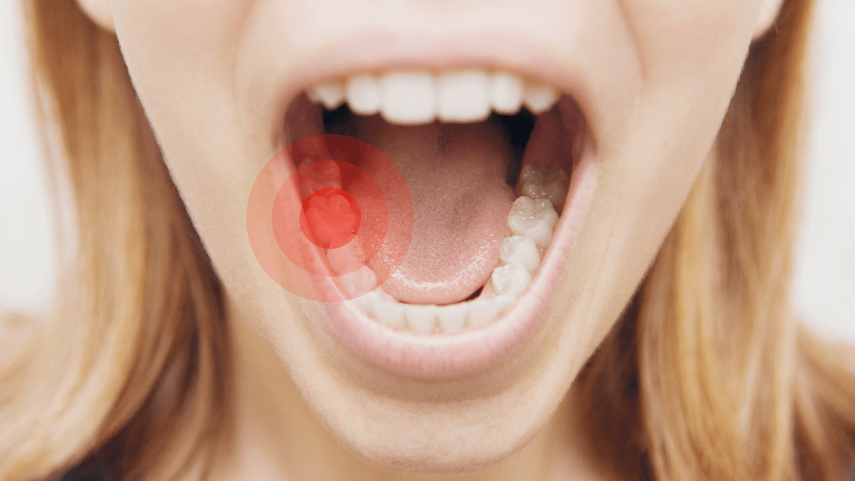 درمان آسان دندان های حساس