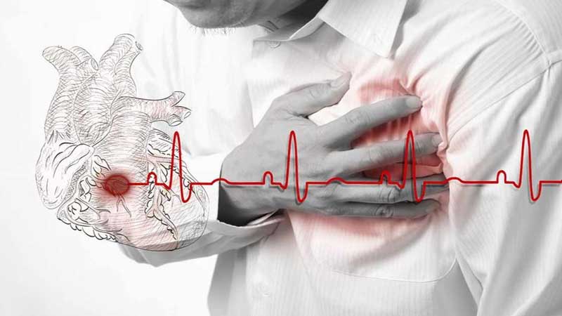 آنژین قلبی یا درد سینه علائم عوارض درمان و پیشگیری