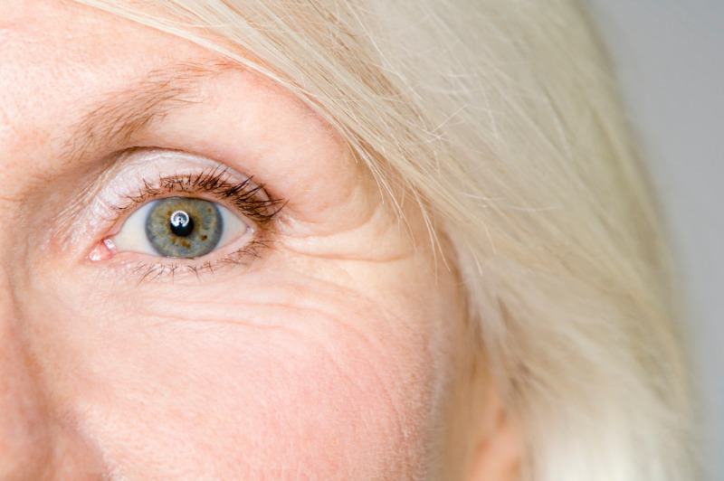 اختلالات شایع چشم در سالمندان