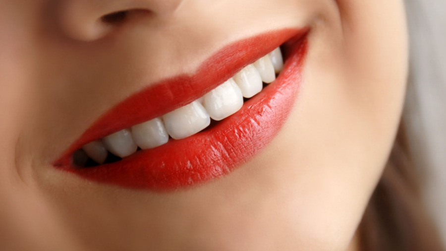 معایب کامپوزیت دندان و مقایسه آن با کامپوزیت ونیر