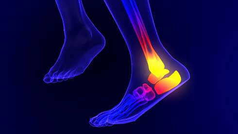 علت درد کف پا و پاشنه پا چیست؟