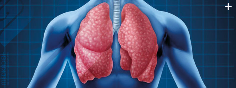 انواع بیماری های تنفسی و درمان آن با اکسیژن ساز