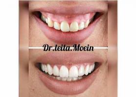 کلینیک دندانپزشکی دکتر لیلا معین