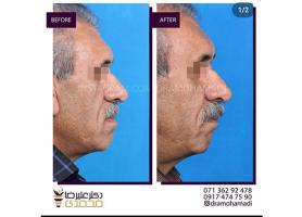دکتر علیرضا محمدی - متخصص جراحی دهان، فک و صورت