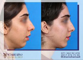 دکتر علیرضا محمدی - متخصص جراحی دهان، فک و صورت