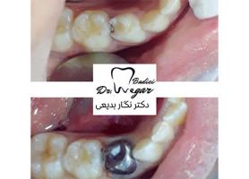 دکتر نگار بدیعی - دندانپزشک، كودكان - زيبایی