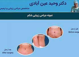 دکتر وحید عین آبادی - متخصص جراحی زیبایی
