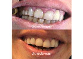 دکتر ندا نصر - دندانپزشک متخصص جراحی لثه و ایمپلنت