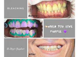 دکتر نگین یزدانی - دندانپزشک ترمیمی و زیبایی