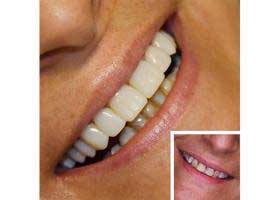 دکتر نگین یزدانی - دندانپزشک ترمیمی و زیبایی