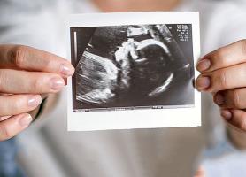 سونوگرافی‌های دوران بارداری