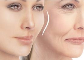 آیا راهی برای رهایی از خط لبخند وجود دارد؟