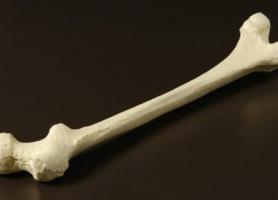 جراحی استخوان چیست؟ 