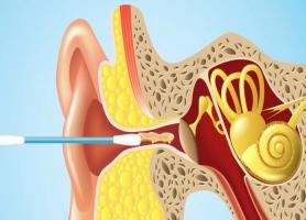 بیماری منییر گوش علائم تشخیص و درمان