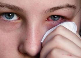 درمان های خانگی برای عفونت چشم