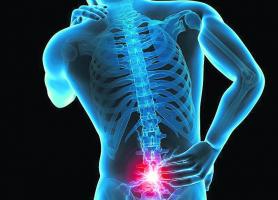 پارگی دیسک کمر ،علل ، علائم ، تشخیص و درمان 