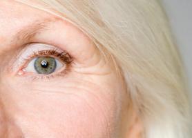 اختلالات شایع چشم در سالمندان