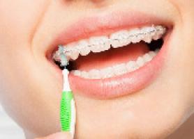 نکات تغذیه ای مهم در زمان ارتودنسی دندان