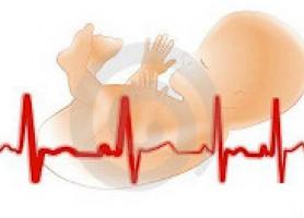 انواع علت عوارض و تفسیر نوار قلب جنین